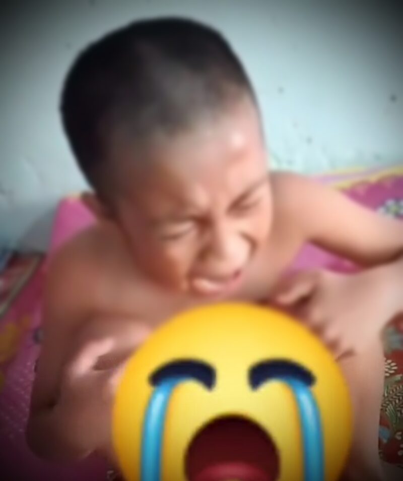 Gambar Kondisi Korban Salah Khitan di Kerinci